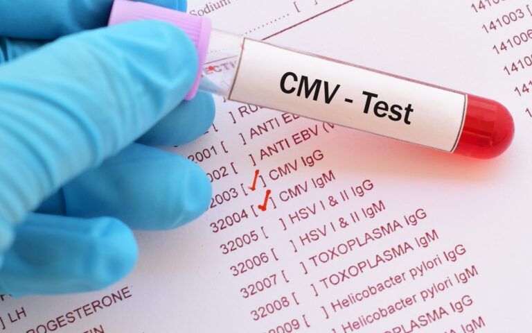 CMV Test